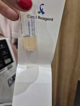 Jaroslava V., 47 let, negativní (2025) - CarciReagent