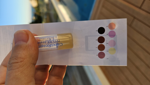 Zdeněk M., 53 let, negativní (2024) - CarciReagent