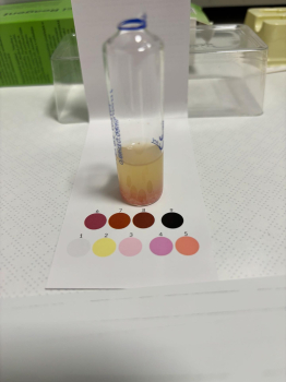 Markéta S., 37 let, negativní (2024) - CarciReagent