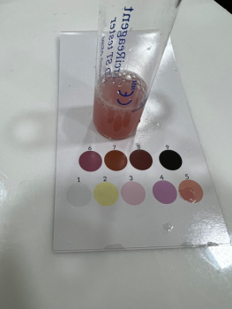 Martin Z., 57 let, pozitivní (2023) - CarciReagent