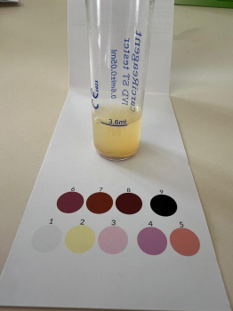 Marek D., 52 let, negativní (2025) - CarciReagent